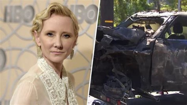 Anne Heche Was Trapped Inside Burning Home For 45 Minutes After Car Crash: Records