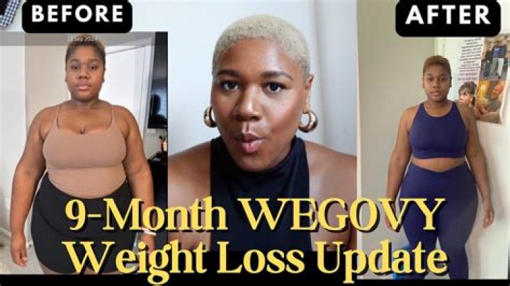 Before & After Pic – Hollywood Life