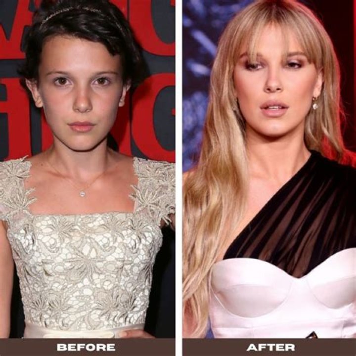 Before and After – Hollywood Life