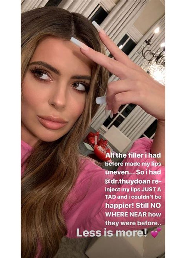 Brielle Biermann Reinjects Lip Fillers 1 Month After Dissolving Them – ‘I Couldn’t Be Happier’