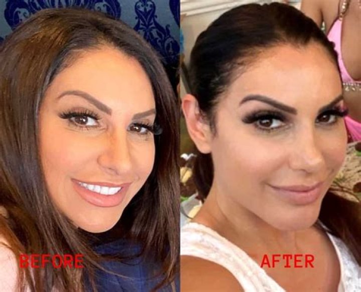 See ‘RHONJ’ Star’s Before & After Pics – Hollywood Life